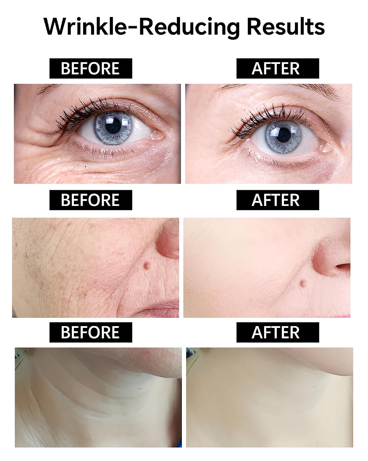 Botox Bee Venom Anti-Wrinkle Cream